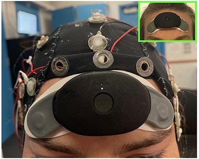 Validation of spectral sleep scoring with polysomnography using forehead EEG device